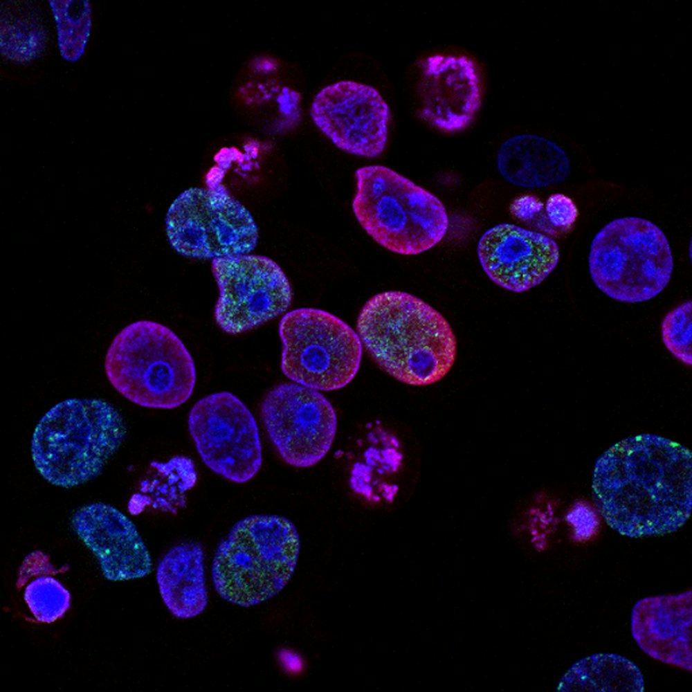 Fluorescence microscopy image of cells in blue and magenta
