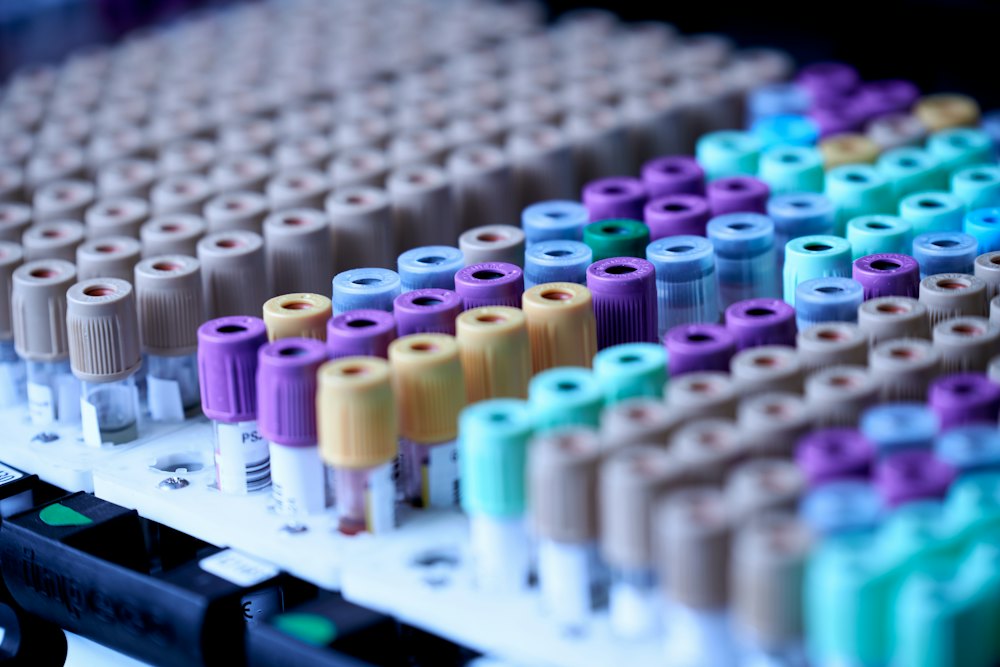 A rack of colorful capped sample tubes in a laboratory